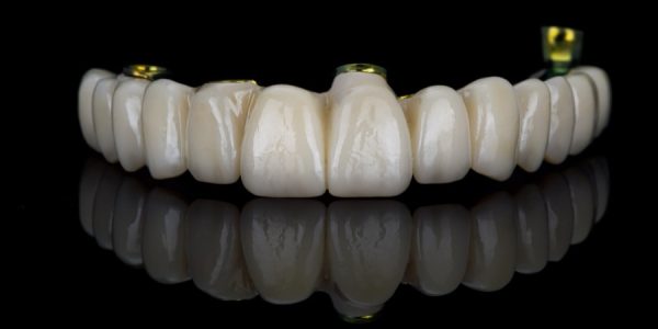dental prosthesis of the upper jaw without gums with a gilded beam inside on black glass with reflection